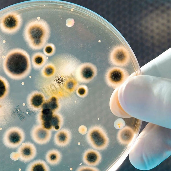 services-MICROBIOLOGY