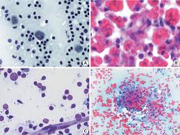 Cytology